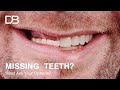 Options For Replacing Missing Teeth | An In Depth Look Reuben Sim