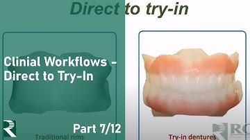 Transition Toward Digital Dentures: Clinical Workflows - Direct to Try-In (7/12)