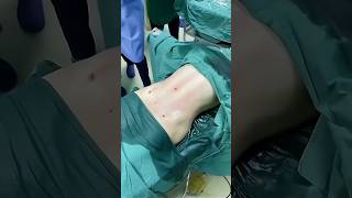 #Waist and abdomen circumference #liposuction #Thigh liposuction