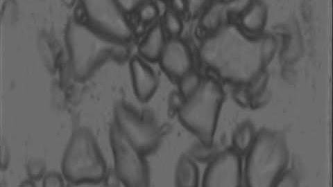 Creation of cavitation activity in a microfluidic device through acoustically driven capillary waves