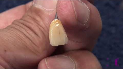 Katana Zirconia UTML A3.5 - Stain & Glaze - Wipeoff Technique - Part 2