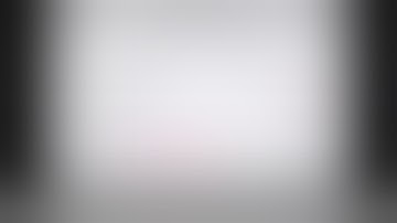 Basic principles of RPD design Cl III by Dr Emad Hanbali