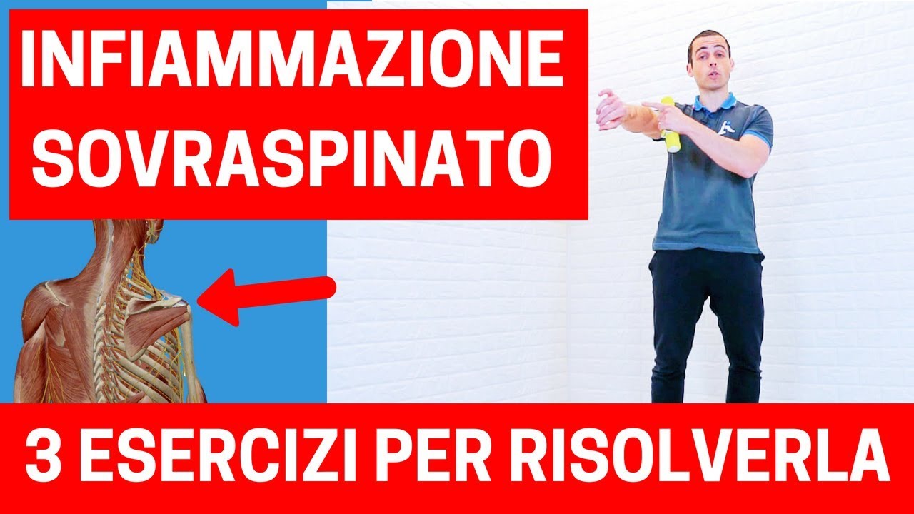 Infiammazione O Lesione Del Sovraspinato Cosa Fare Esercizi Molto Efficaci Youtube