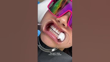 freestyle tooth gem 💎 #torontotoothgems #toothgems #toothgemsupplies
