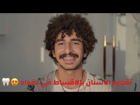 تقويم الاسنان بالاقساط الشهريه في