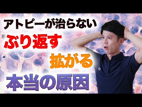 わくたよしのぶ【アトピー・超敏感肌のくすり屋】