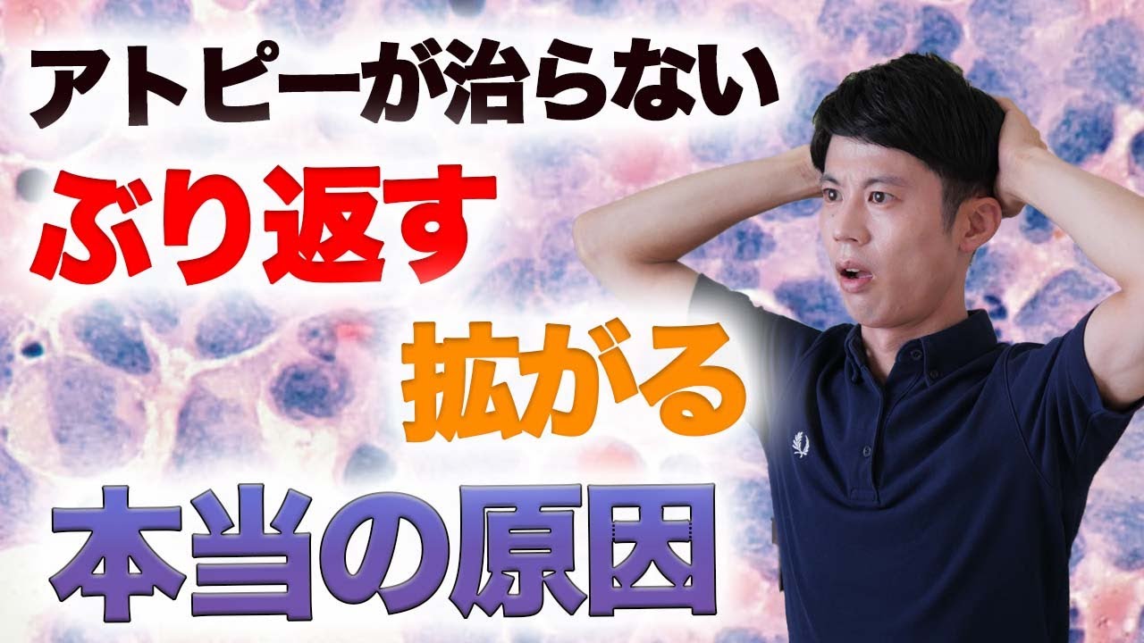 How to cure atopic dermatitis] Causes of recurrence and spread of