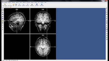 1. VMR creation and Talairach transformation