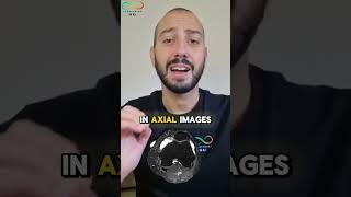 MRI Knee Tips & Tricks #mrtech #radiographer #mri #radiology