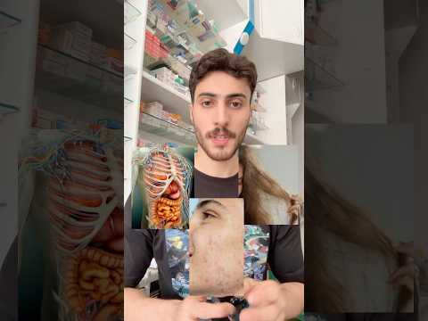 عاده بتدمر جسمك وصحتك وشعرك وكمان بشرتك وكلنا بنعملها