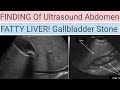Findings of Ultrasound Abdomen!Fatty Liver! Gallbladder Stone!#ultrasoundmadeeasy86@123radiology