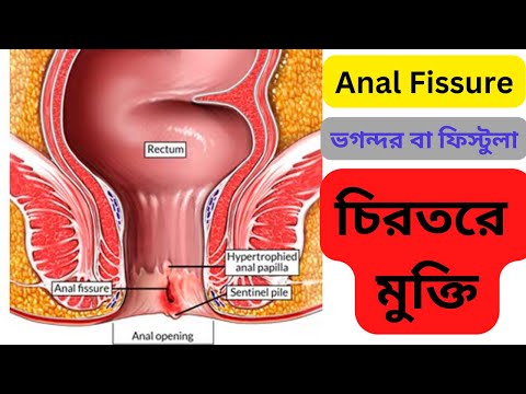 Alsouning yalangoch fotosurati Analda tulki dumi haqida video