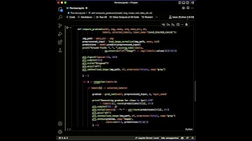 Diagnosis X-Ray Images With Deep Learning