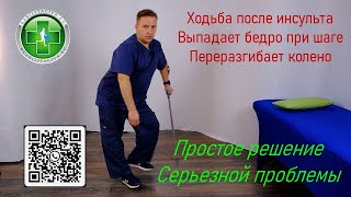 картинка: Нарушение походки после инсульта. Выпадает назад бедро парализованной ноги, переразгибает колено.