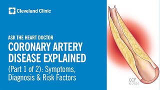 Ask the Heart Doctor | Coronary Artery Disease Explained: Symptoms, Diagnosis & Risk Factors