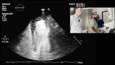 Contrast (and myocardial perfusion assessment) with Dr Faraz Pathan and Sam Orde