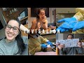 Invisalign Vlog 1: attachments and first trays (adjusting to the new normal!)