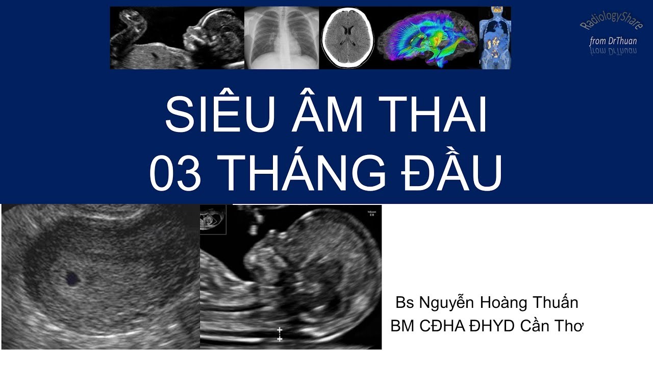 Siêu âm thai 3 tháng đầu - youtube