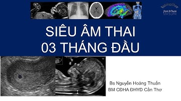 Siêu âm thai 3 tháng đầu