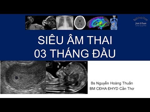 Video Siêu âm thai 3 tháng đầu - youtube