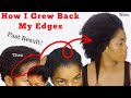 OMG 😳! Grow Your Edges and Bald Spots Fast with this Treatment/real result 💯