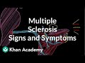 Understanding Multiple Sclerosis