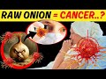 How raw onions can cause cancer or dementia avoid eating raw onions with these foods