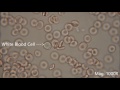 Red blood cells under the microscope, hypo and hypertonic solutions