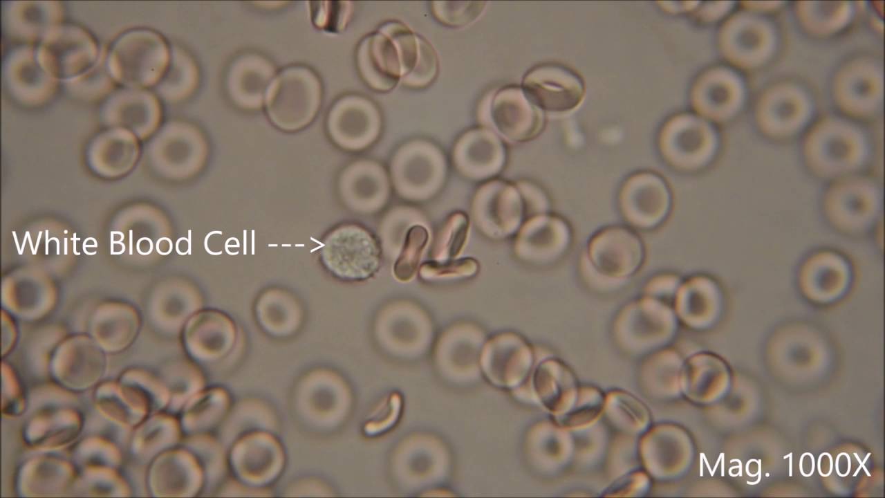 Monarch Got ready Diver Red blood cells under the microscope, hypo and hypertonic solutions -  YouTube