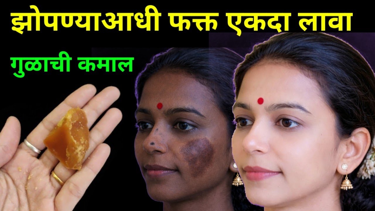 वांग डाग काळवटपणा करा चुटकीत गायब😱 | टाकाऊ पासून टिकाऊ वस्तू | wang dag upay