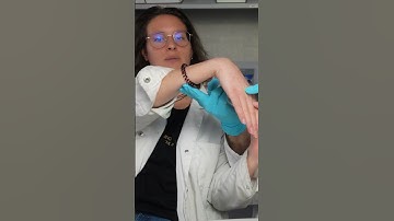 how to break a wrist indirectly 🦴🤕 #bones #science