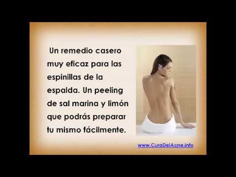 Como eliminar las espinillas de la espalda