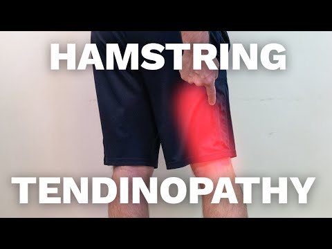 Video: 3 moduri de a trata tendinopatia cronică a hamstringului
