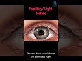 Pupillary Reflex Examination | CN II & III Light Reflex Test Tutorial