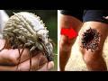 See What the World’s Most Dangerous Insect Can Do Mp3 Song