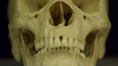 Solving cold cases by 3D printing skulls