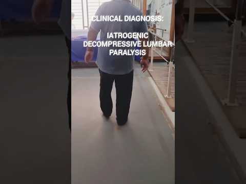 Iatrogenic Decompressive Lumbar