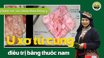 Hỗ trợ điều trị u xơ tử cung bằng thuốc nam - Đông y gia truyền họ Lý Ba Vì