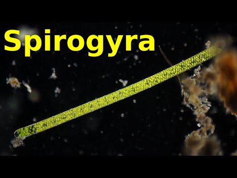 Spirogyra - Under the Microscope