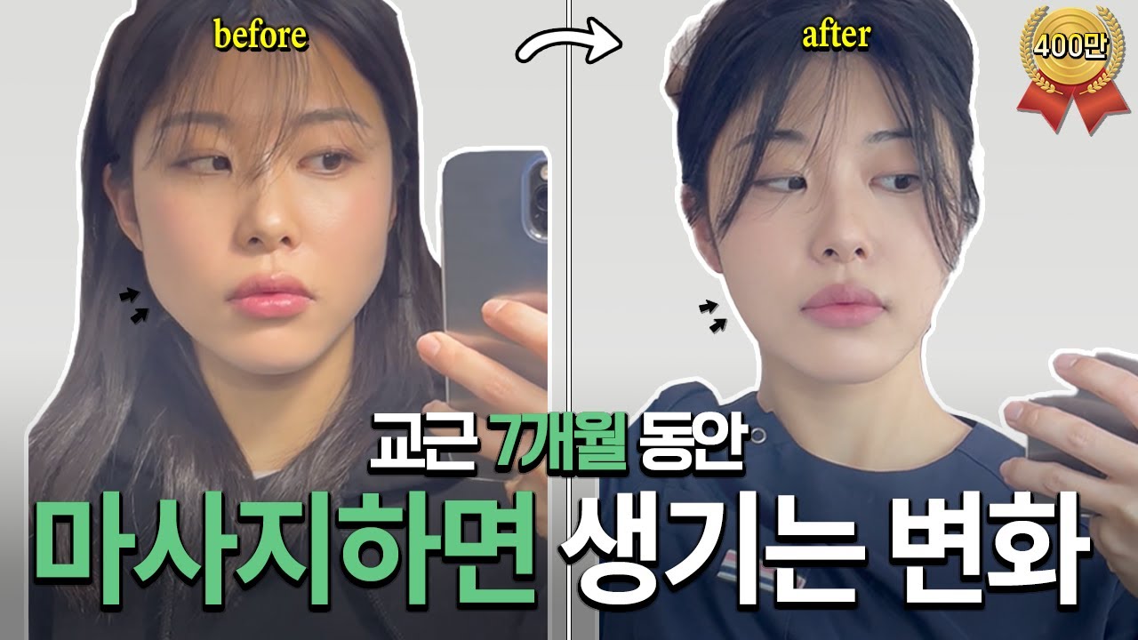 [ENG] 7개월 후, 내 얼굴이 달라진 이유 | 7 Months Later, the Reason Why My Face Looks Different