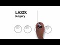 MN EYE What Is LASIK MN EYE What Is LASIK