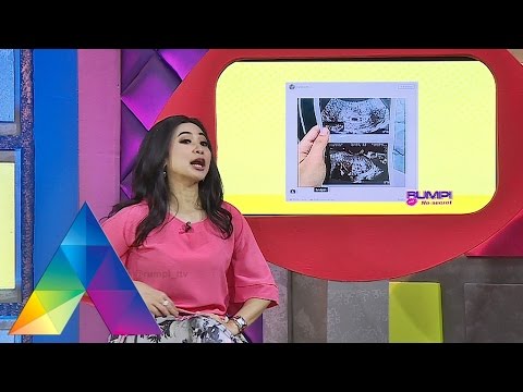 RUMPI - Dahlia Poland Hamil 5 minggu (14/03/16)