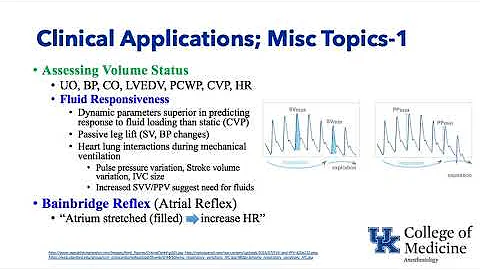 Keyword Review 2019 | Fluids & Anesthesia - (Dr. S...