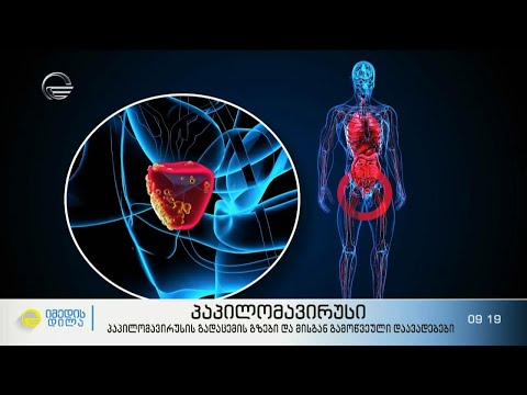 პაპილომავირუსის გადაცემის გზები, მისგან გამოწვეული დაავადებები და ვაქცინაცია თავდაცვისთვის