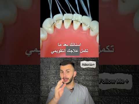 مثبت الأسنان بعد التقويم طب اسنان تقويم اسنان تقويم الأسنان طبيب اسنان معلومات طبية