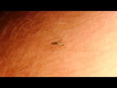 Tips to Avoid Gnat Bites And Ways to Treat Them Right