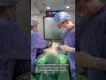Three-point Contouring+Nasolabial Fold Surgery with Autologous Bone Grafting #shorts