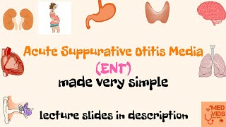 Acute Suppurative Otitis Media | ASOM | ENT | Med Vids made simple