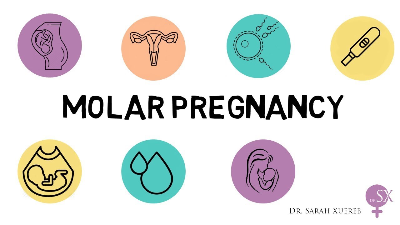 Molar Pregnancy