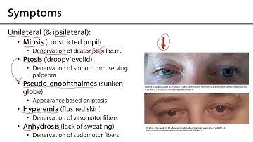 Larynx and Pharynx LO - Horner